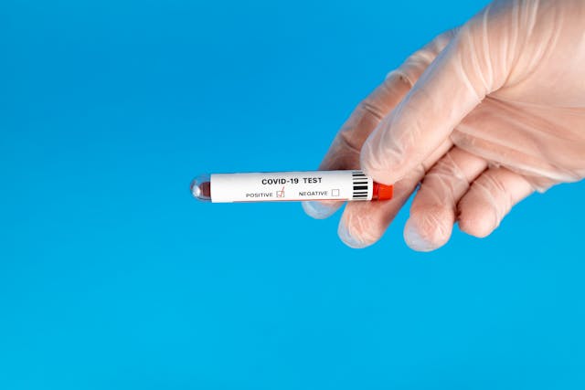 Illustrative image A Person Holding a Vacutainer used in Accordemy®'s training on Infectious Disease and Public Health